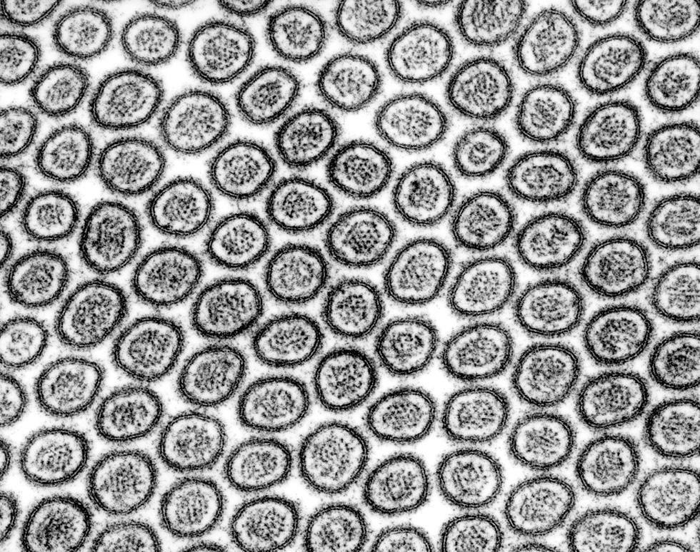 Microvilli in transverse section